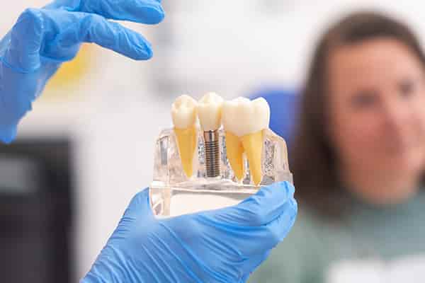 Hand holding dental implant model.